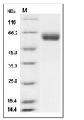 VNN1 Protein, Mouse, Recombinant (His)