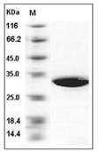 SULT1A1 Protein, Human, Recombinant (His)