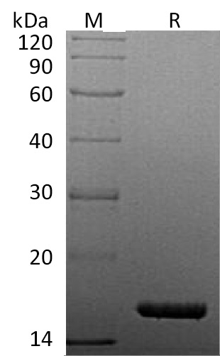 TNF alpha Protein, Human, Recombinant (aa 77-233, His)