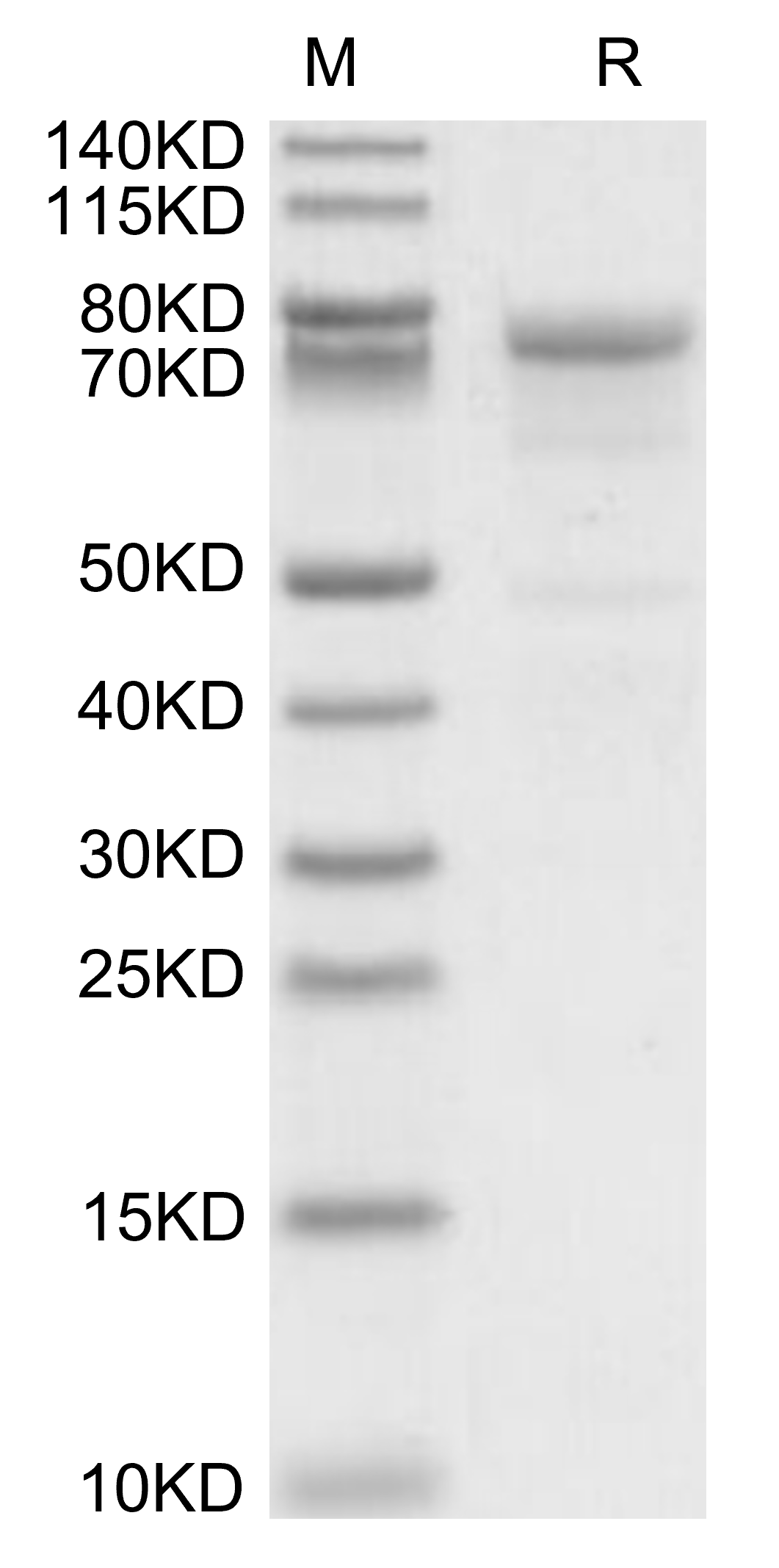 KLKB1 Protein, Human, Recombinant (His)