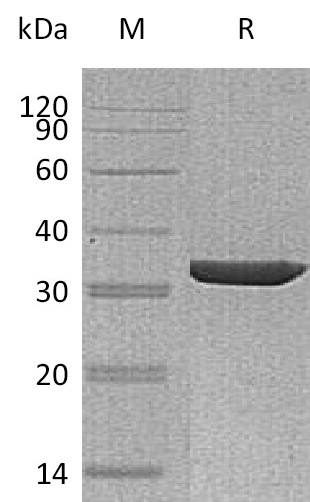 ANXA3 Protein, Human, Recombinant