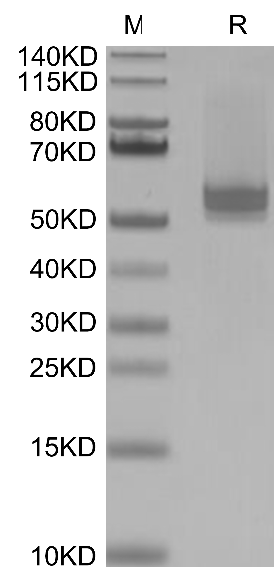 BAFF/TNFSF13B Trimer Protein, Human, Recombinant (His & Flag)