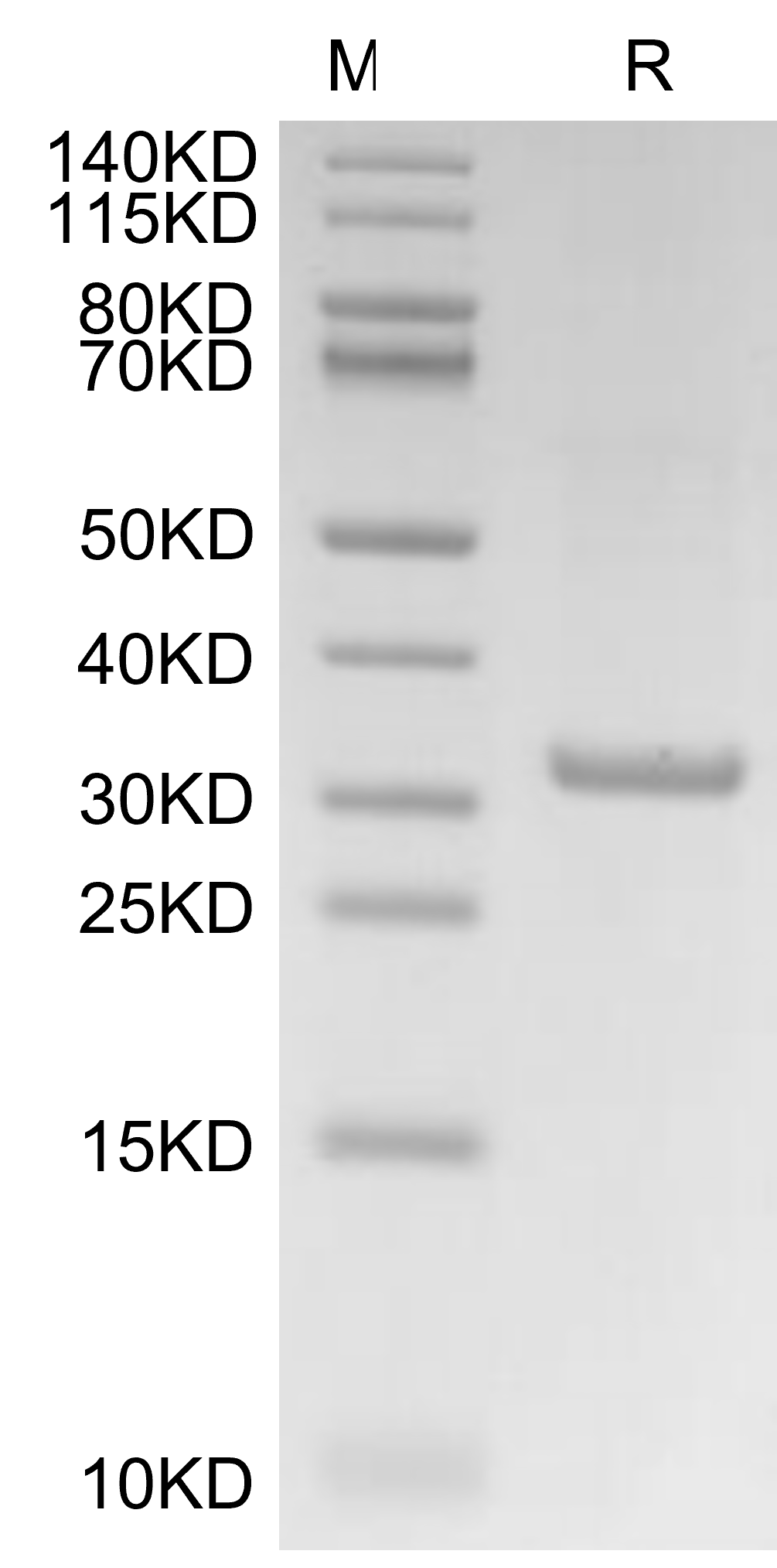 IgE Protein, Human, Recombinant (His & Avi)