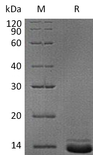 NPY Protein, Human, Recombinant (His)