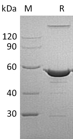 NAMPT Protein, Human, Recombinant (His)