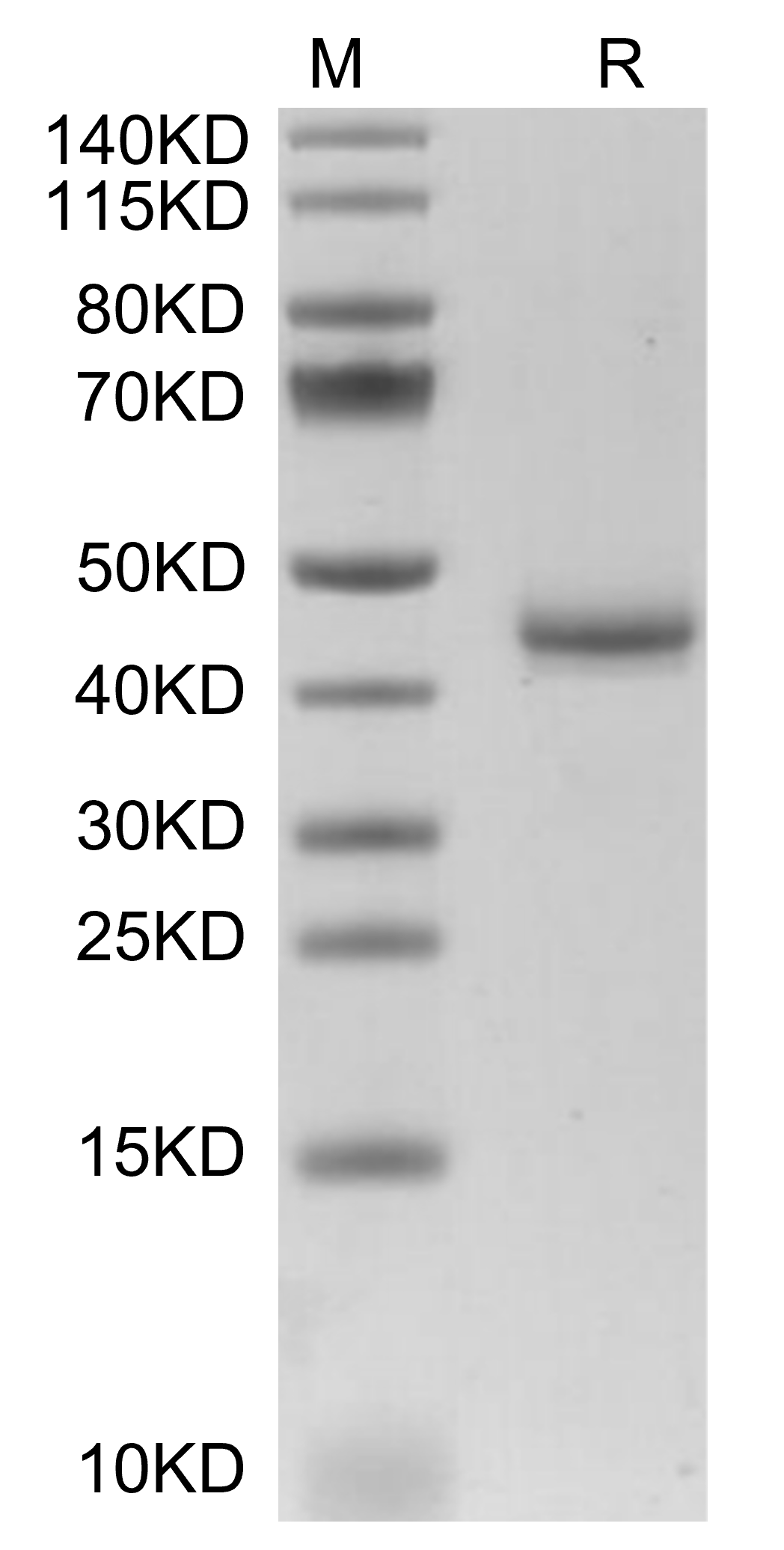 CALCA/CGRP Protein, Mouse, Recombinant (hFc)