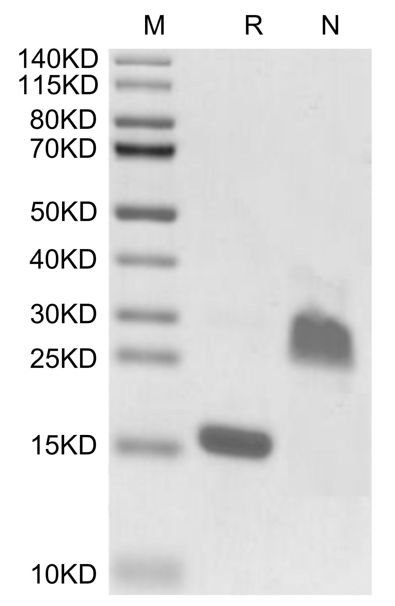 GDF-15 Protein, Rat, Recombinant (His)