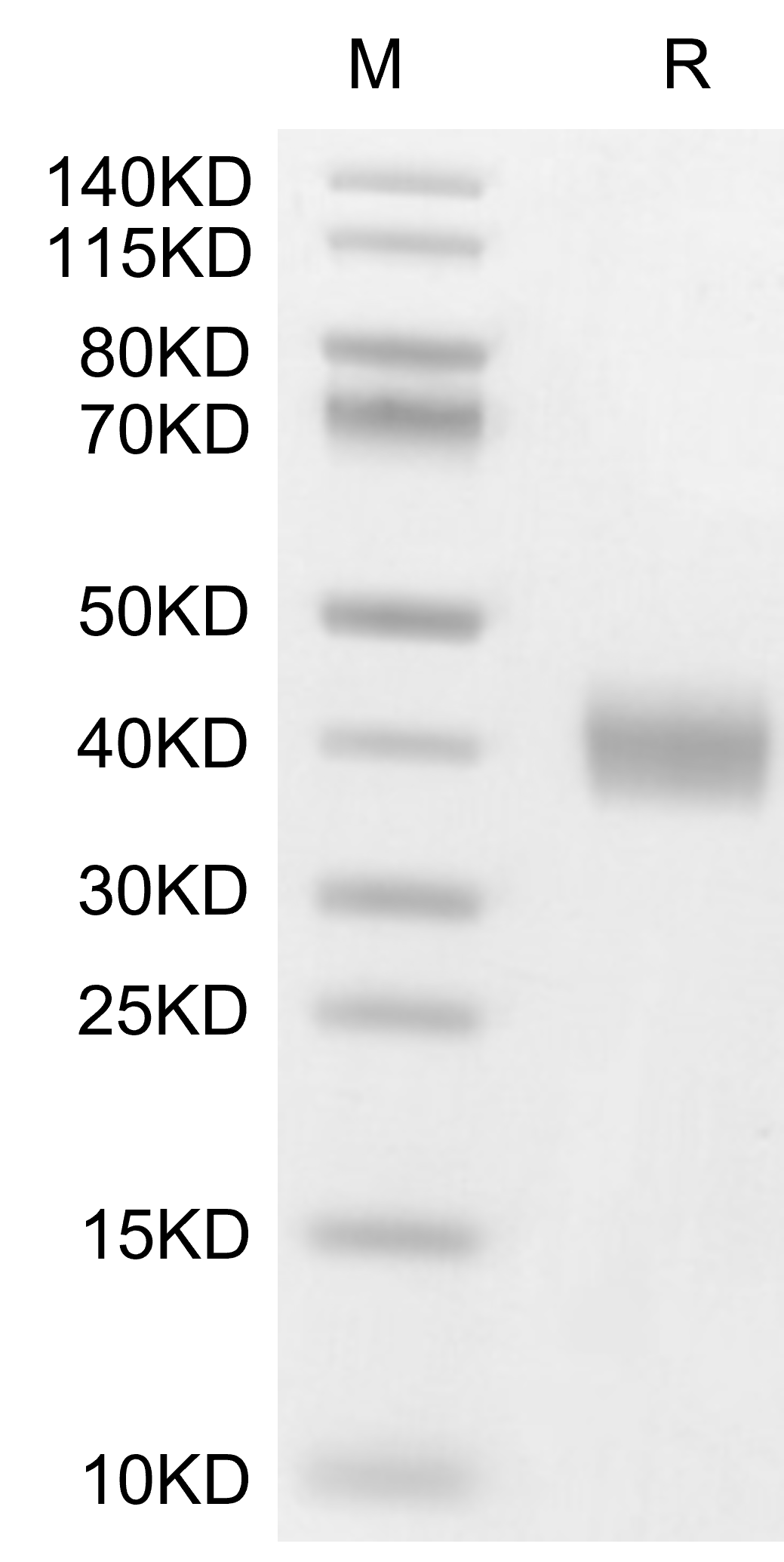 Galectin-3 Protein, Human, Recombinant (His)