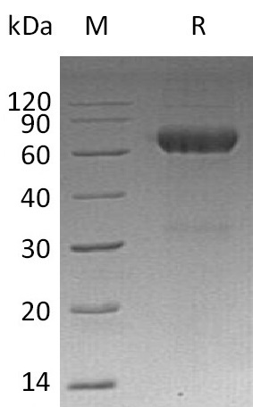 MMP-12 Protein, Mouse, Recombinant (His)