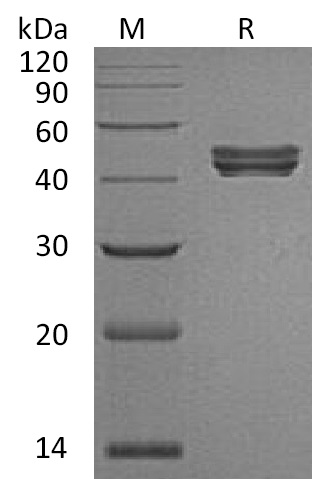 Sialidase-1 Protein, Human, Recombinant (His)