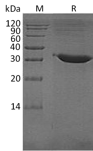 TPSB2 Protein, Human, Recombinant (His)