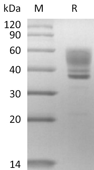 IL-13 Protein, Human, Recombinant (mFc)