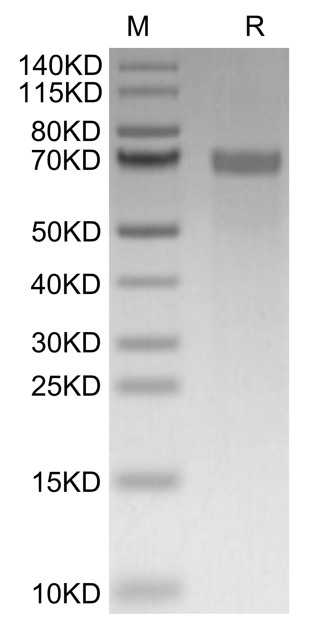 Tenascin Protein, Human, Recombinant (His)