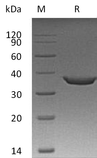 Sting Protein, Human, Recombinant (Sumo & His)