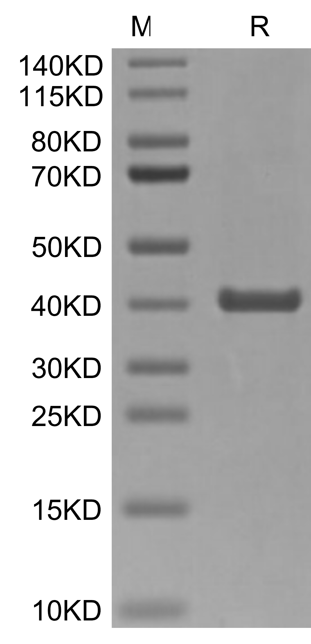 ANXA2 Protein, Mouse, Recombinant (His)