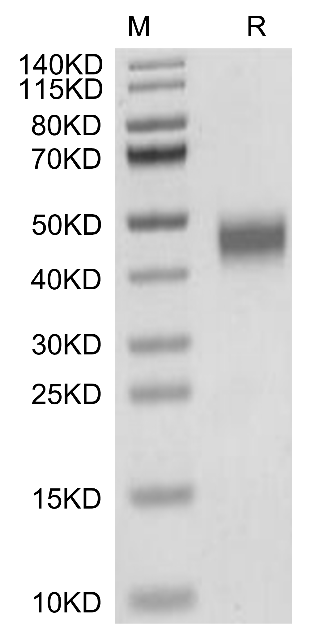 MXRA8 Protein, Human, Recombinant (His)