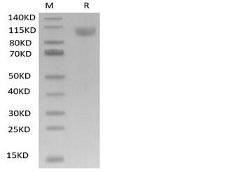 ACE2/ACEH Protein, Human, Recombinant (His & Avi)