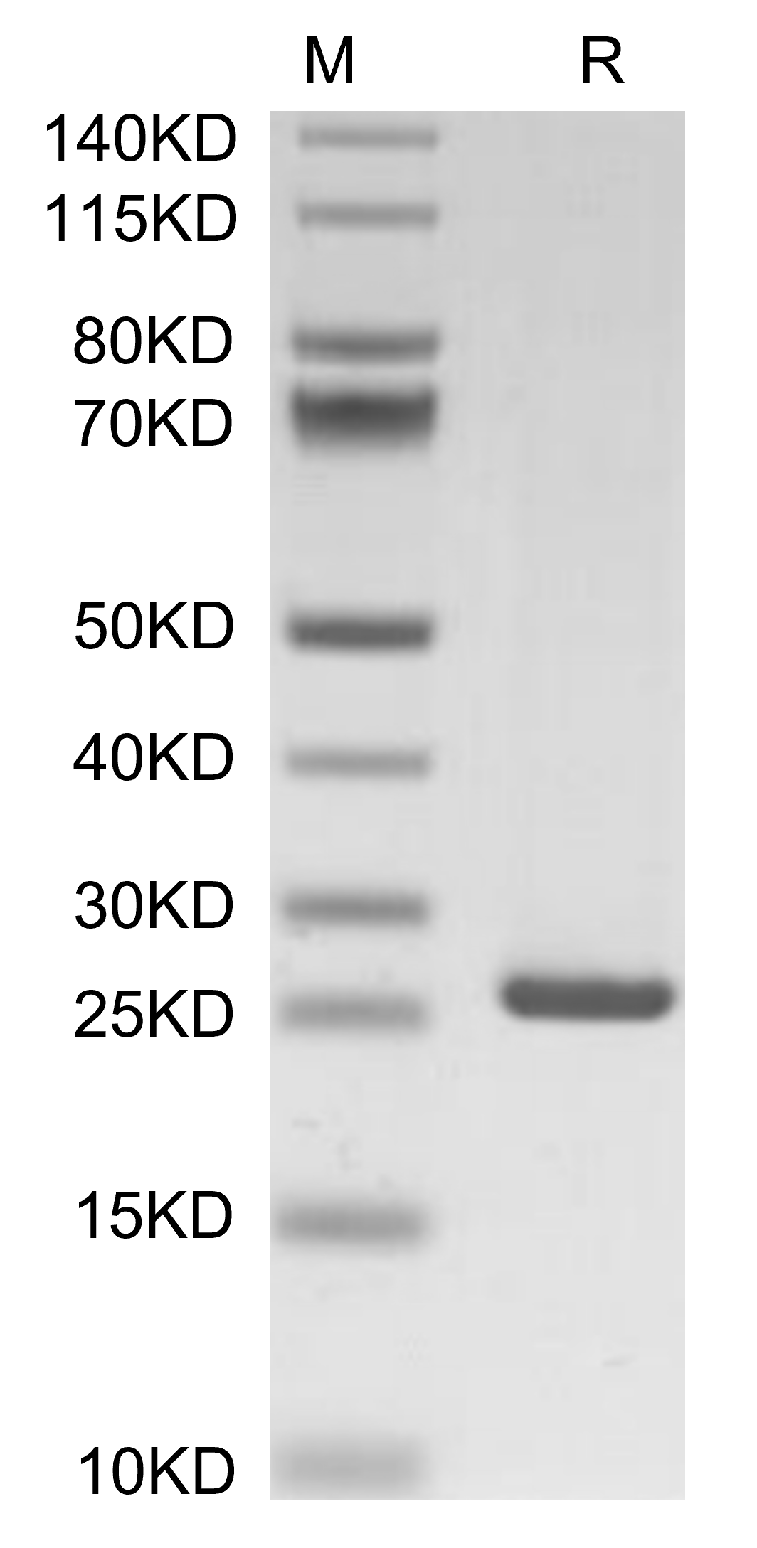 C-Reactive Protein /CRP Protein, Human, Recombinant (His)