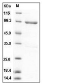 MKK4 Protein, Mouse, Recombinant (His & GST)