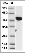 VRK1 Protein, Human, Recombinant