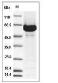 ACOX1 Protein, Human, Recombinant (His)