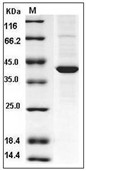 ABHD4 Protein, Human, Recombinant (His)