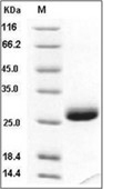 TIMP-1 Protein, Human, Recombinant