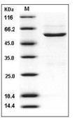 CDK4 Protein, Human, Recombinant (GST)