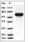 CD131 Protein, Human, Recombinant (His)