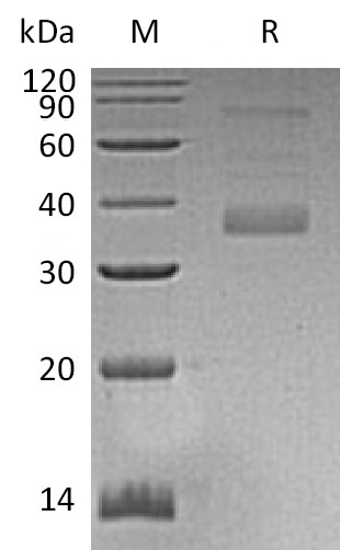 MFAP4 Protein, Human, Recombinant (His)