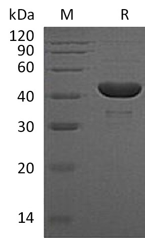 PGK1 Protein, Human, Recombinant (His)