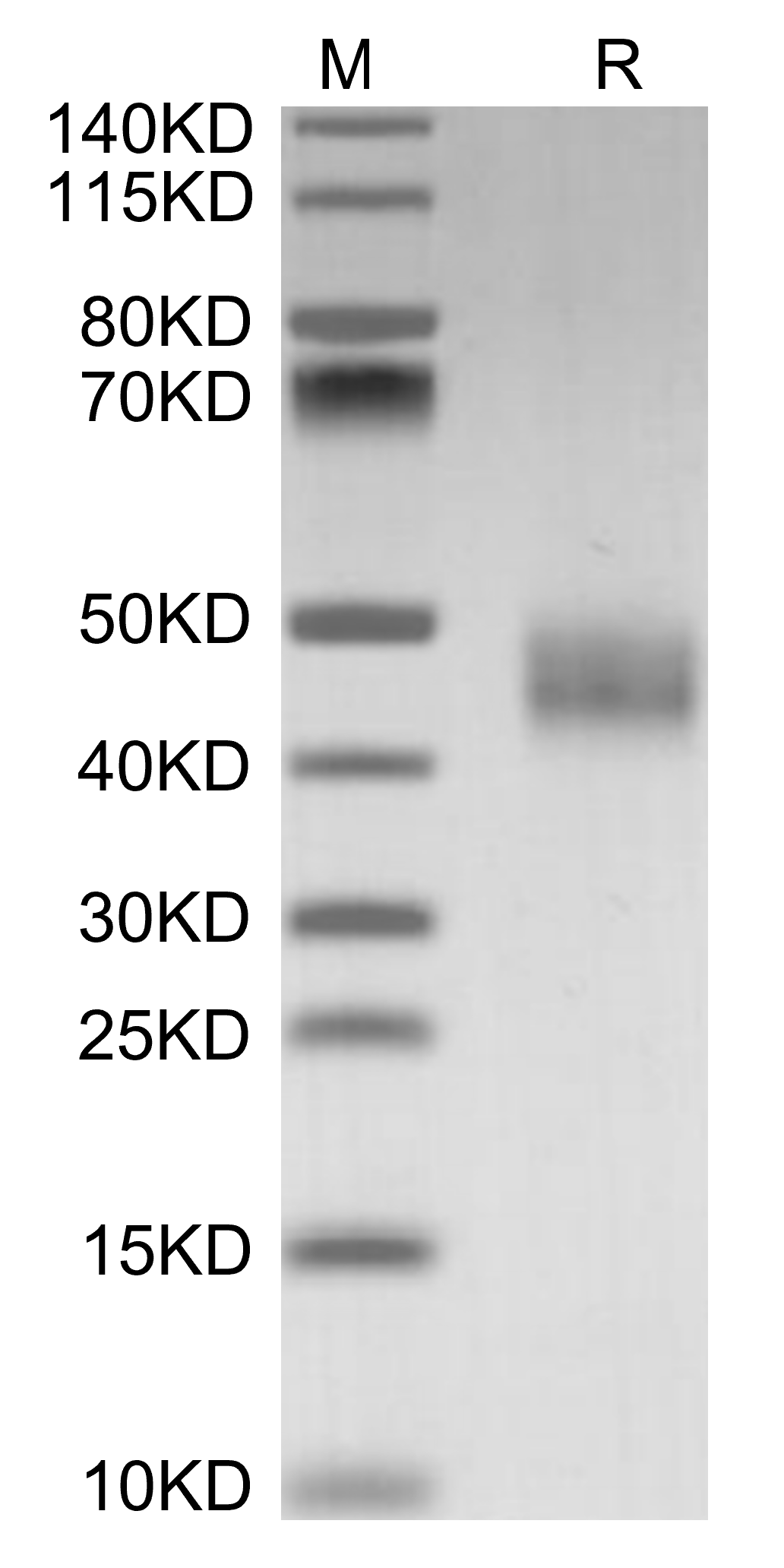 Galectin-3/LGALS3 Protein, Mouse, Recombinant (His)