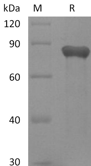 GAS6 Protein, Human, Recombinant (His)