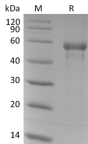 B3GAT1 Protein, Human, Recombinant (His)