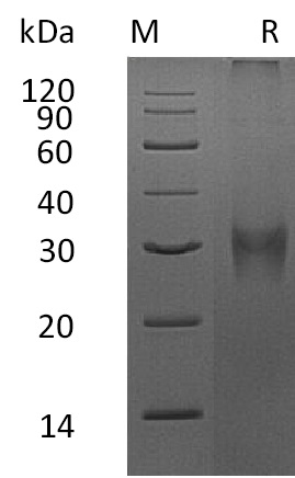 Asprosin Protein, Mouse, Recombinant (His)