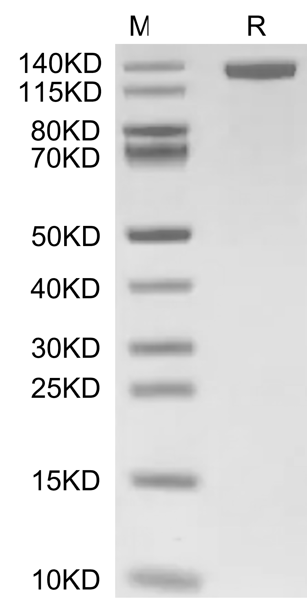 CD163 Protein, Human, Recombinant (His & Avi)