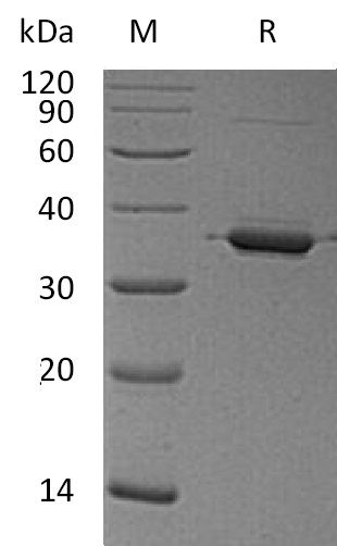 ANXA2 Protein, Human, Recombinant