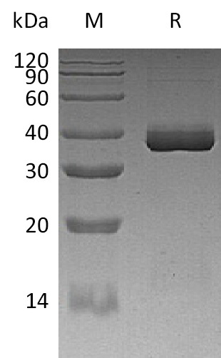 Apolipoprotein E/APOE3 Protein, Human, Recombinant (His)